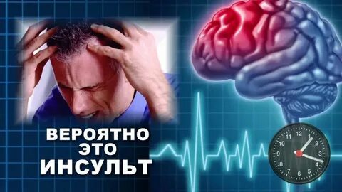 Инсульт лекция