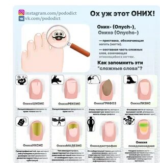 Значения слова ноготь