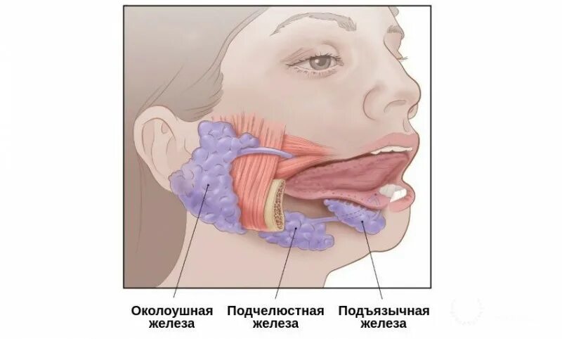 Сиалоаденит слюнной железы. Сиалоаденит околоушной слюнной. Выводной проток околоушной слюнной железы воспаление. Околоушная железа является железой