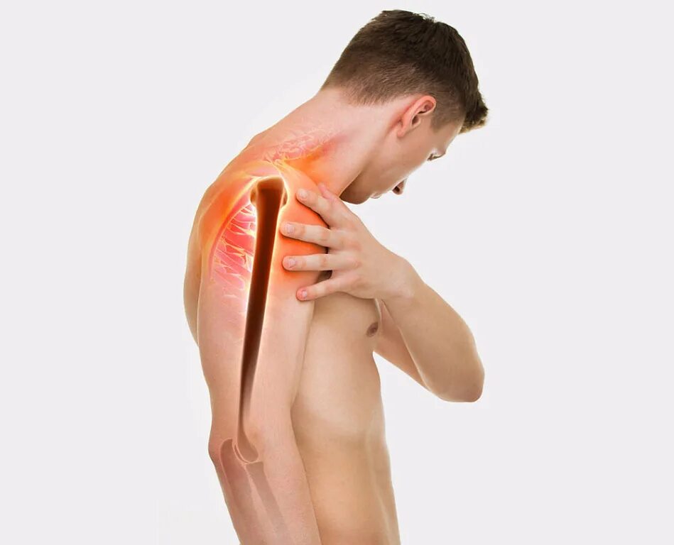 Сильная боль в области плечевого сустава. Нестабильность плечевого сустава.