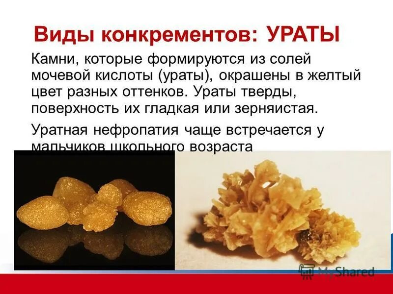 микроскопия осадка мочи кошки. как вывести соли мочевой. как вывести соли мочевой. как вывести соли мочевой кислоты. отложения солей в суставах симптомы.