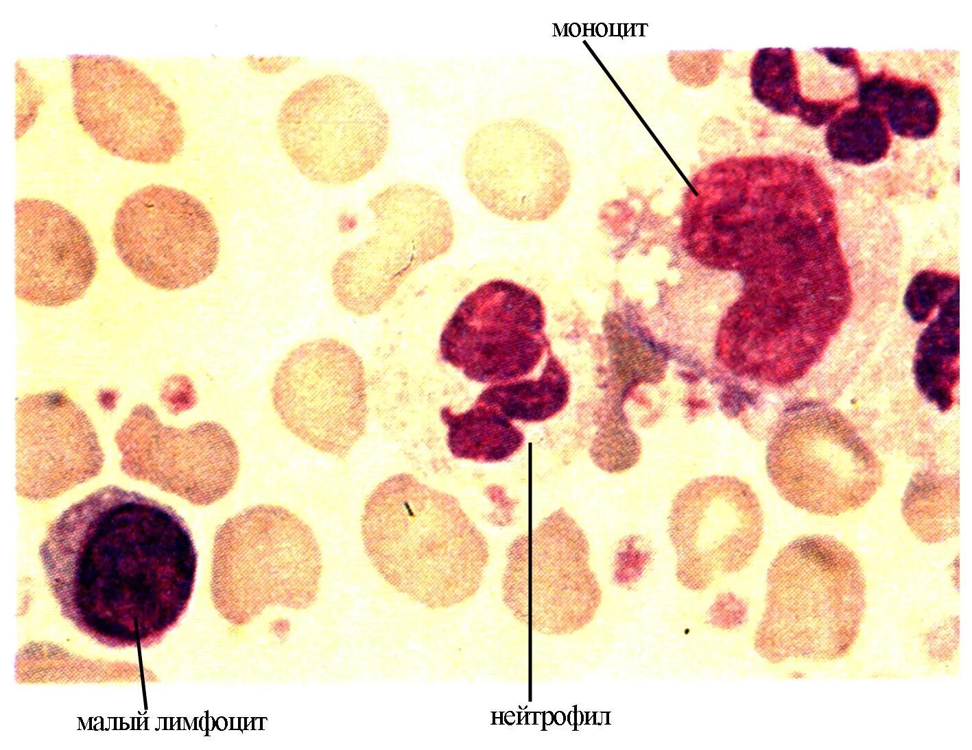 Нейтрофилы лимфоциты моноциты. Лейкоциты лимфоциты и макрофаги. Клетки крови нейтрофилы. Моноциты под микроскопом в крови. Макрофаги и нейтрофилы