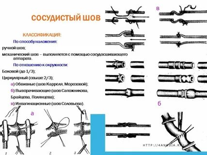 Перечислите ручные операции