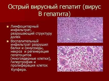 Купферовские клетки печени