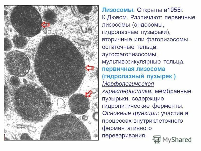 Лизосома электронная микрофотография. Лизосомы в микроскопе. Лизосомы под электронным микроскопом. Лизосомы строение под микроскопом.