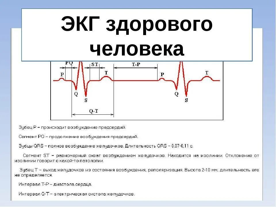 Как расшифровать кардиограмму