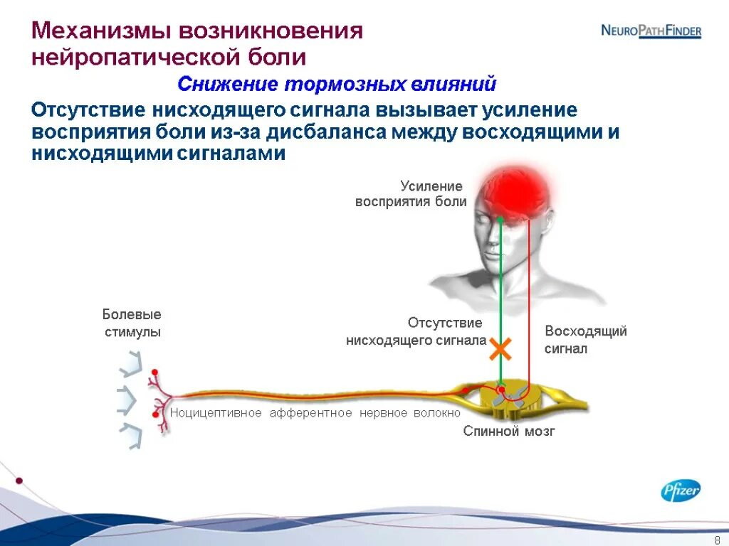 Фантомные боли лечение. Механизм нейропатической боли. Механизм возникновения боли. Нейропатическая боль механизм возникновения. Механизм формирования нейропатической боли.