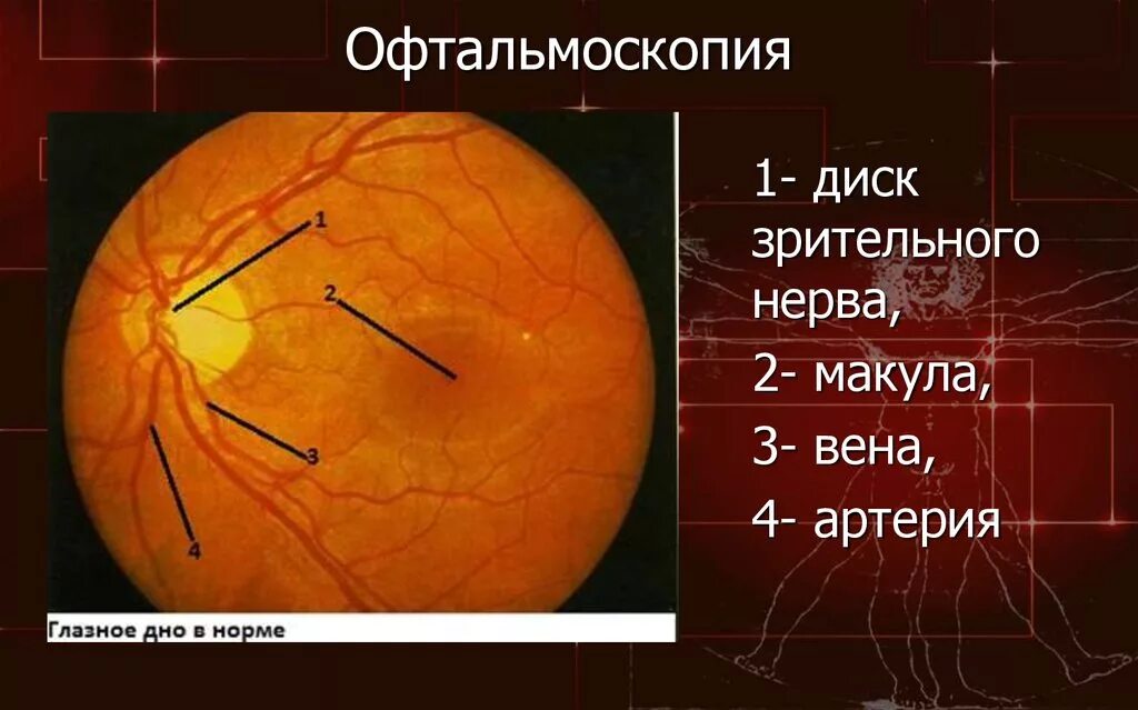 Офтальмоскопия что это. Офтальмоскопия глазного дна норма. Макула и диск зрительного нерва. Диск зрительного нерва при офтальмоскопии. Глазное дно при офтальмоскопии норма.