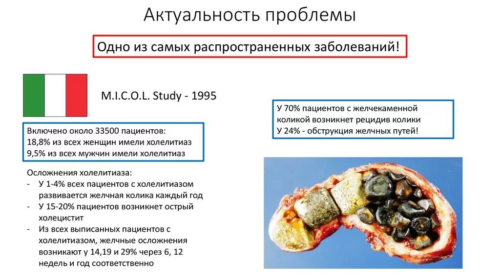 Холецистолитиаз желчного. Осложнения холелитиаза. Холецистит холелитиаз. Холелитиаз что это за болезнь. К осложнениям, обусловленным холелитиазом.