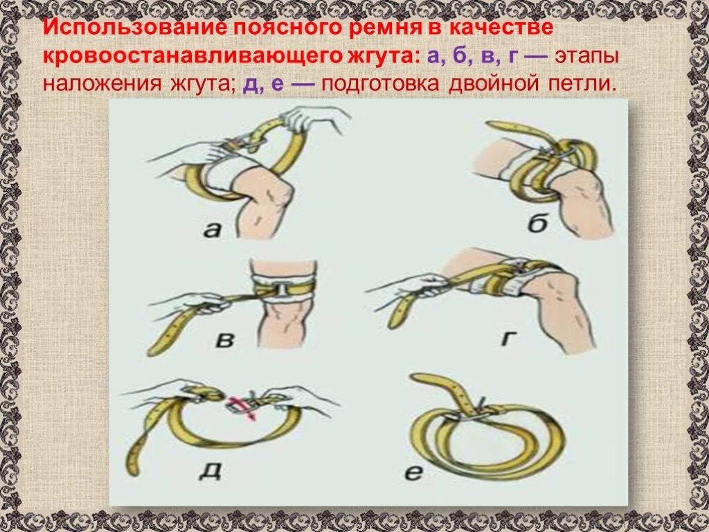 В качестве импровизированного жгута можно использовать. Использование поясного ремня в качестве кровоостанавливающего жгута. наложить кровоостанавливающий жгут. этапы наложения кровоостанавливающего жгута. наложение кровоостанавливающего жгута при кровотечении.