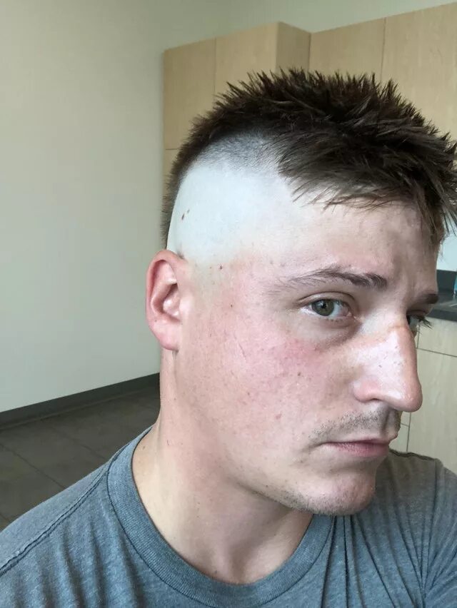 Лысый затылок. Смешные прически мужские. Ужасные стрижки. Уродливая прическа. Плохая стрижка.