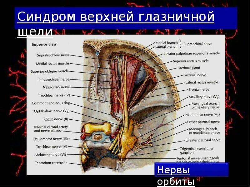 Через глазничную щель проходят. Верхняя глазничная щель анатомия. верхняя глазничная щель нервы. синдром верхней глазничной щели. верхняя надглазничная щель.