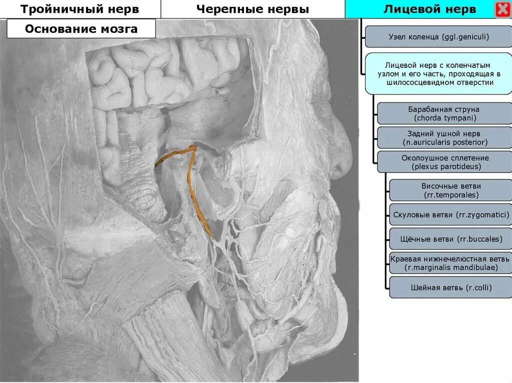 Узлы черепных нервов. Узел коленца лицевого нерва. Черепные нервы лицевой нерв. Черепно мозговые сплетения. Тройничный мозговой нерв.