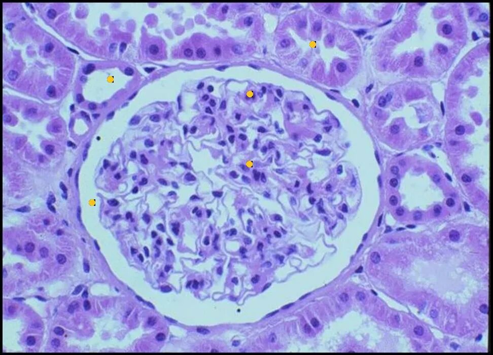 Почечный клубочек гистология. Почечное тельце гистология препарат. Почка микропрепарат гистология. Почечный клубочек гистология препарат.