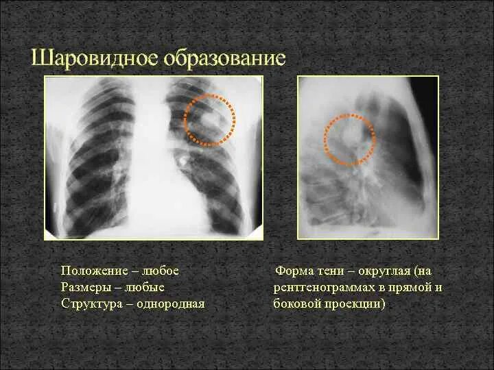 Неоднородное округлое образование