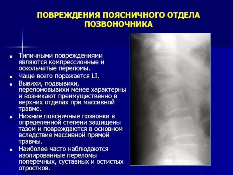 Повреждения позвоночника переломы. Неосложненный компрессионный перелом позвоночника. Компрессионный перелом шейного отдела позвоночника симптомы. Компрессионные переломы тел поясничных позвонков. Компрессионный перелом позвонков.