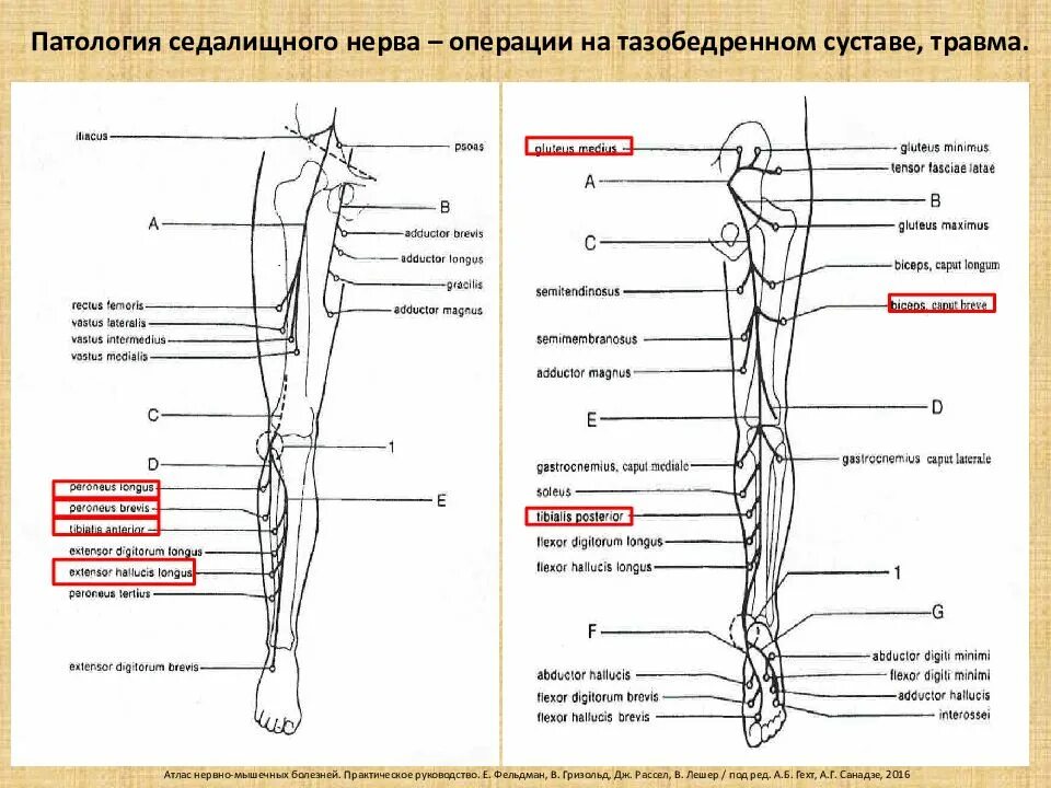 Седалищный нерв анатомия схема. Седалищный нерв анатомия топография. Sedalishni Nerv vetvi. Двигательные волокна седалищного нерва. Неврологические боли в ногах