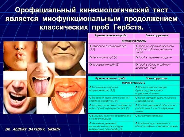 Миофункциональные нарушения в логопедии. Миофункциональная коррекция в логопедии. орофациальная дисфункция. миофункциональная терапия в логопедии.