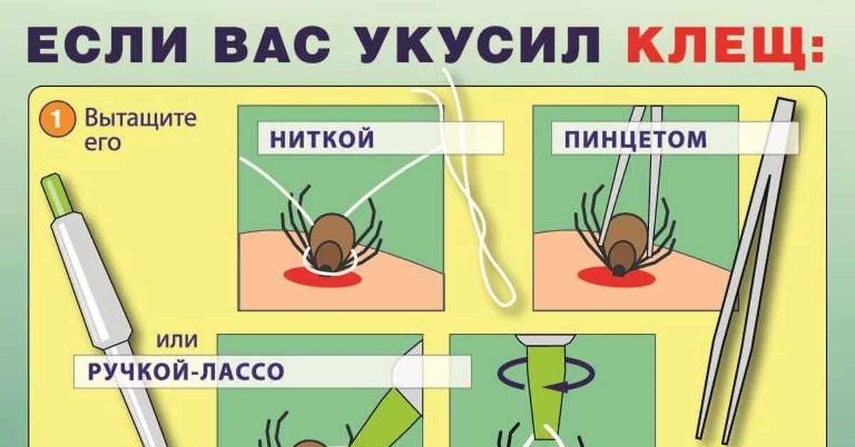 Как правильно удалить клеща. Как вытащить клеща у человека.