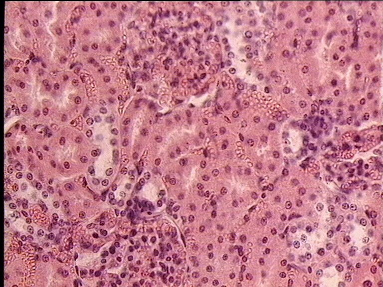 Тканеобразование гистология. Частная гистология препараты по гистологии. Гистология новосибирск. Пин простаты гистология. Гистология новосибирск.