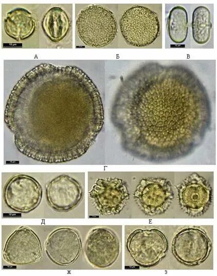 Пыльца и споры. Пыльца микроскопия атлас. Пыльцевые зерна растений атлас. Пыльца в микроскопии кала. Пыльца растений в Кале под микроскопом.