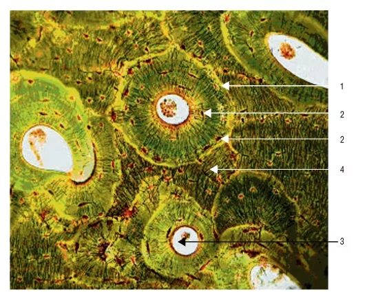 Пластинчатая костная ткань по методу Шморля. Пластинчатая костная. Пластинчатая костная ткань окраска по шморлю. Препарат пластинчатая костная ткань окр по методу Шморля. Остеон 2