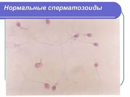Аномалия головки