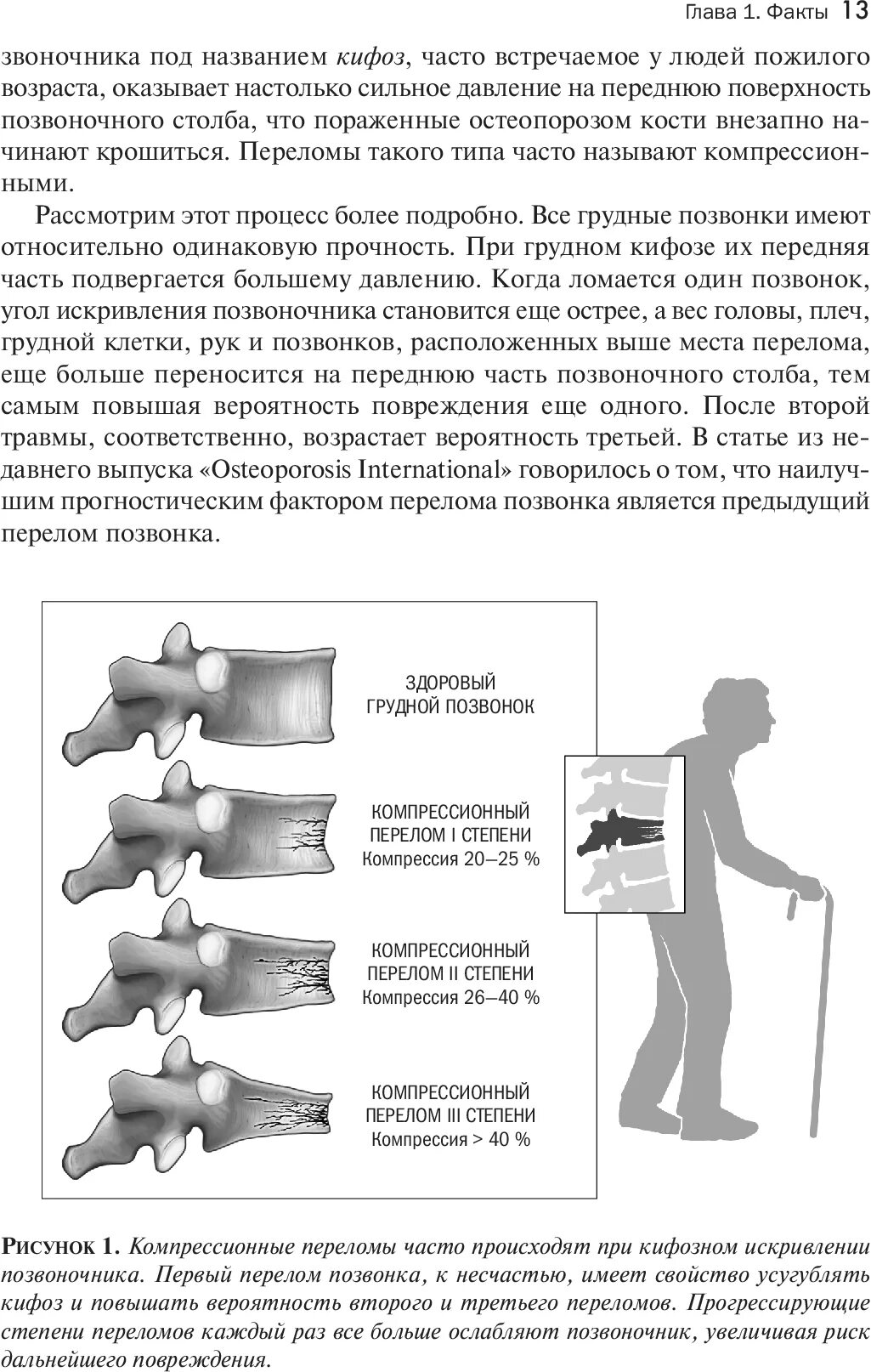 степени компрессии переломов тел позвонков. степени клиновидной деформации тел позвонков. классы компрессии компрессионного трикотажа. классификация компрессионных переломов позвонков. классы компрессии компрессионного трикотажа.