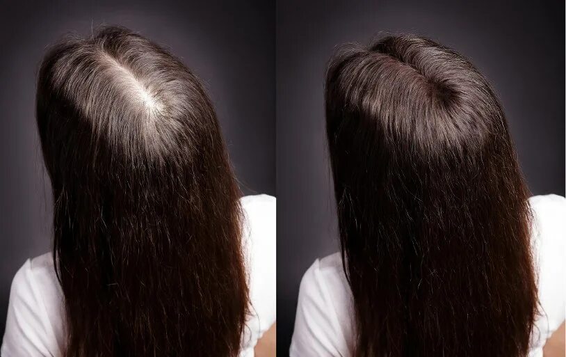 Cómo proteger el cabello de los daños de la planchita y el secador de forma natu