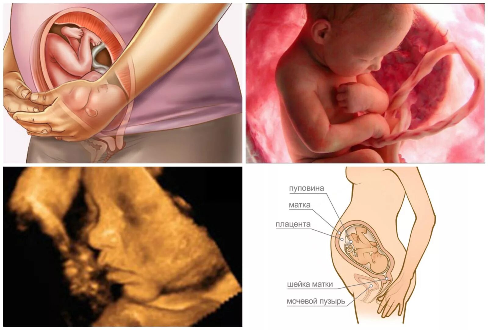 Матка на 35 неделе беременности. Плод на 35-36 неделе беременности. 35 Акушерская неделя беременности. Малыш на 36 неделе беременности в утробе. Расположение ребенка в матке.