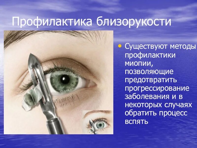 В некоторых случаях возможна