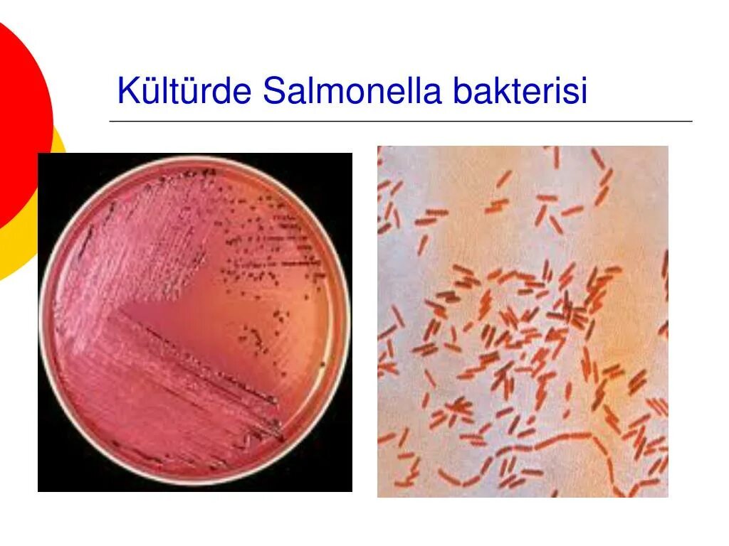 Houtenae сальмонелла. Salmonella typhi микробиология. Сальмонелла рисунок микробиология. Сальмонеллез микробиология. Сальмонеллез материал