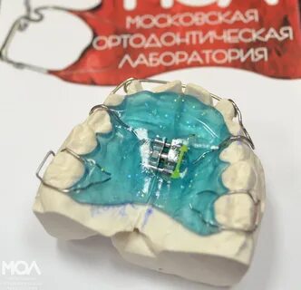 Передняя пластинка