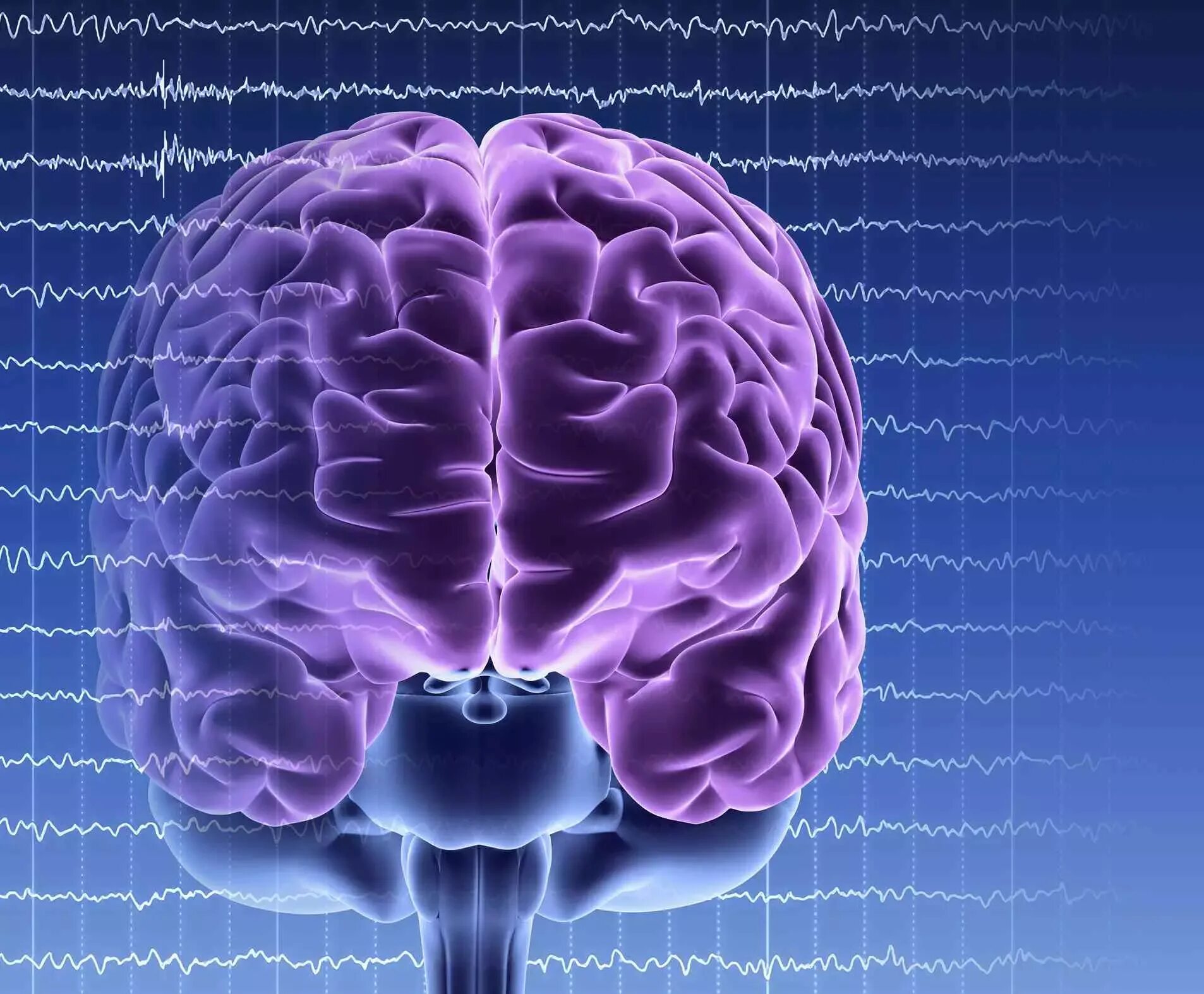 Эпилепсия головной мозг. Смерть мозга. Фон эпилепсия