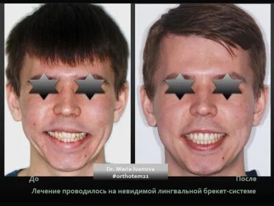 Неправильная коррекция