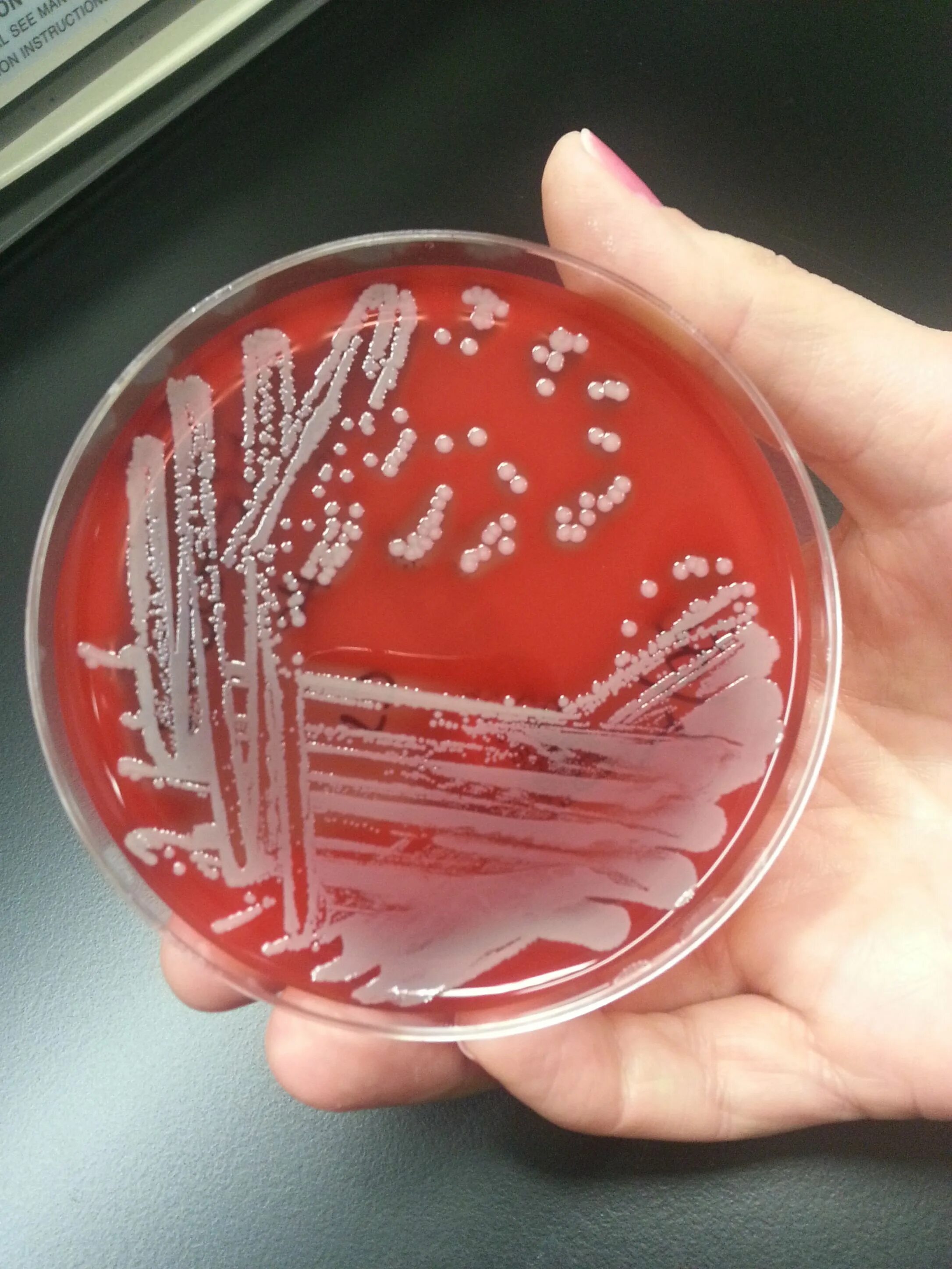 2 staphylococcus aureus. S. aureus золотистый стафилококк. бактерия стафилококк ауреус. стафилококк ауреус микроскоп. стафилококк золотистый staphylococcus aureus.