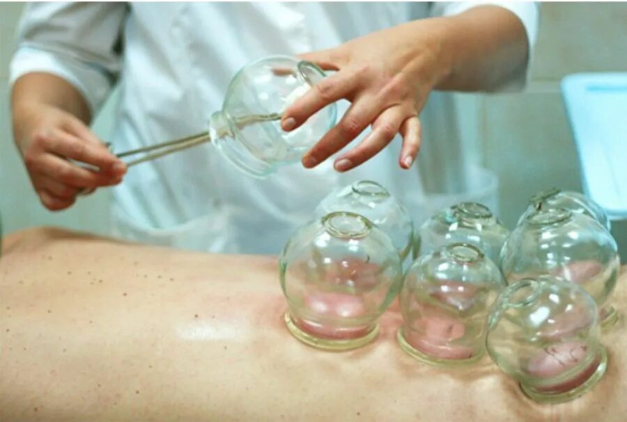 вакуумно баночный массаж. установка банок. массаж стеклянными банками. вакуумный массаж для мужчин. медицинский банки на спину.