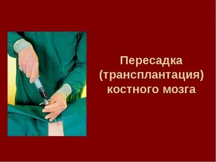 Трансплантация мозга человека
