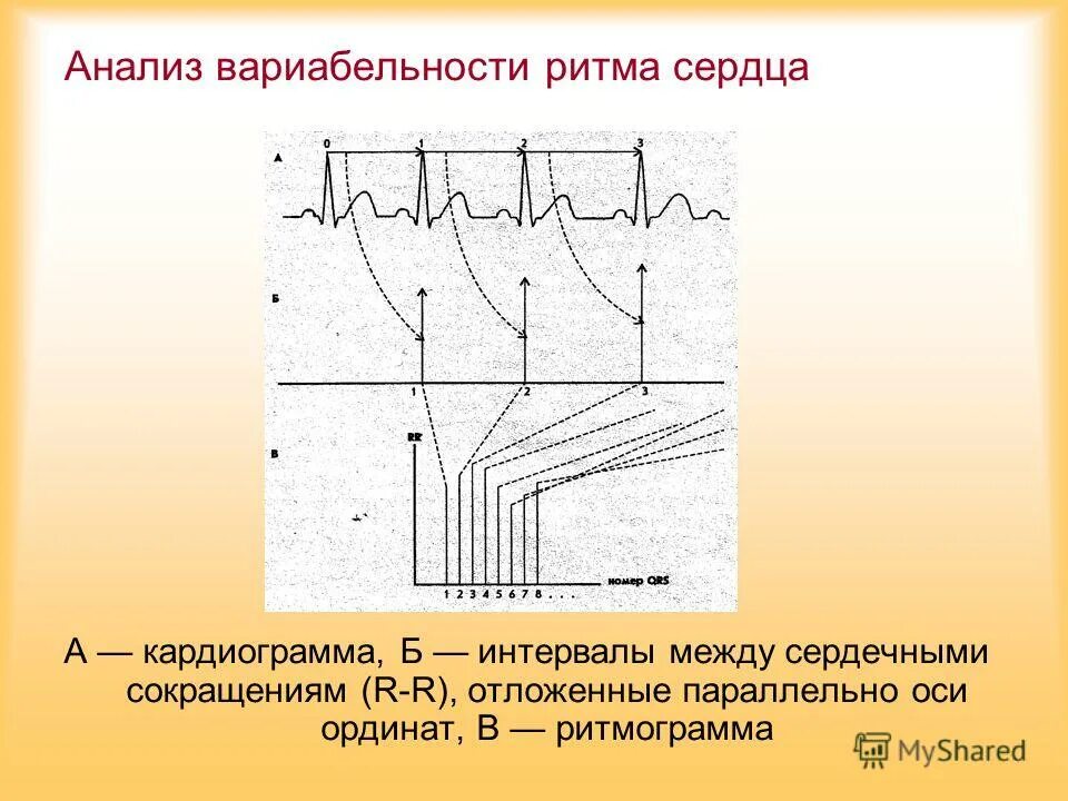 Вариабельность сердечного ритма