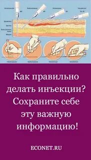 Под каким углом делают инъекции