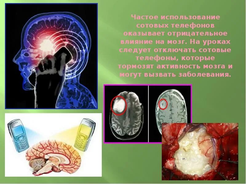 Влияние телефона на мозг человека. Влияние на активность мозга сотового телефона. Влияние телефона. Влияние на активность мозга