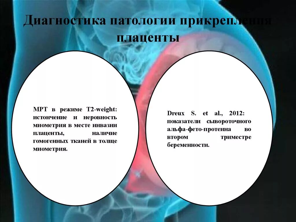 Патология последа