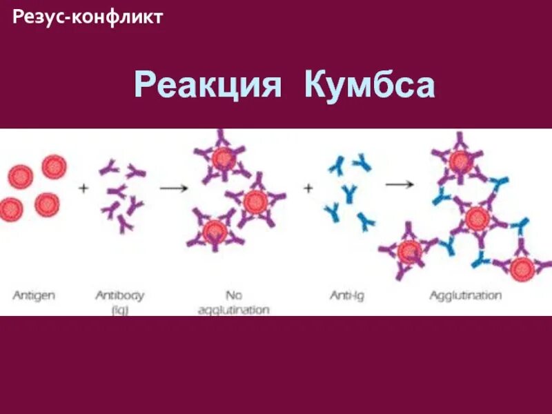 Реакция кумбса непрямая гель-фильтрация что это. Реакция антиген-антитело. Реакция кумбса. Реакция антиген-антитело. Реакция кумбса микробиология.