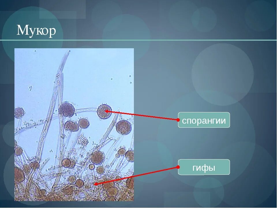 Мукор тело. Клетка гриба мукора. Споры гриба мукора. Мукор в микроскопе. Строение спорангия мукора.