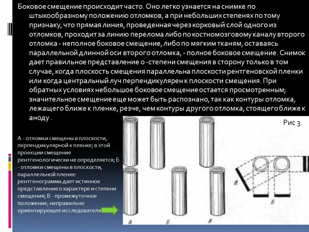 Коллимированный источник света это. Параллельное смещение рисунок. Параллельный сдвиг. Длина поперечных швов. Ход лучей в резонаторе.