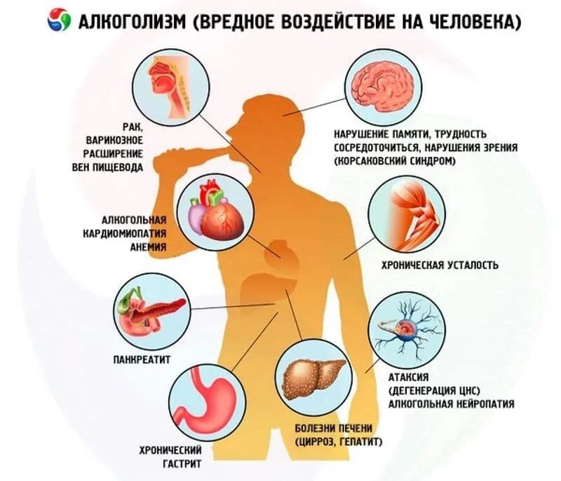 Болезни вызванные алкоголем. Алкоголизм влияние на организм.