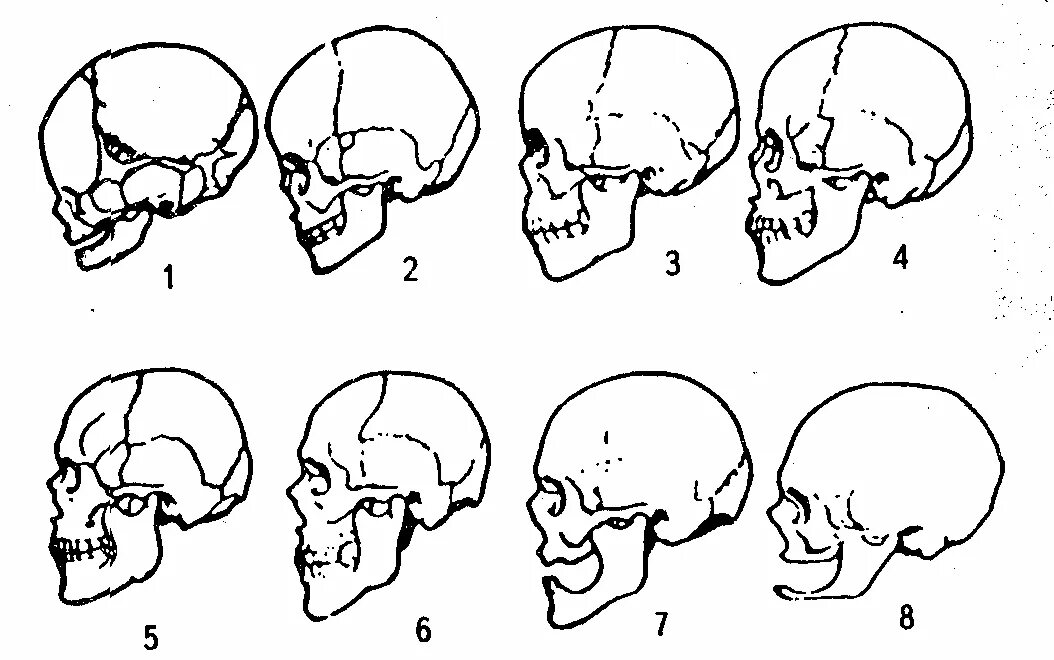 Варианты формы черепа. Формы черепа человека. Форма черепа у взрослого человека. Формирование черепа человека.