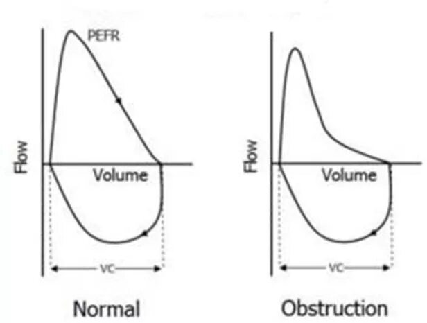 Flow loop. Flow volume loop. volume loop. loop flow. volume two loop language.