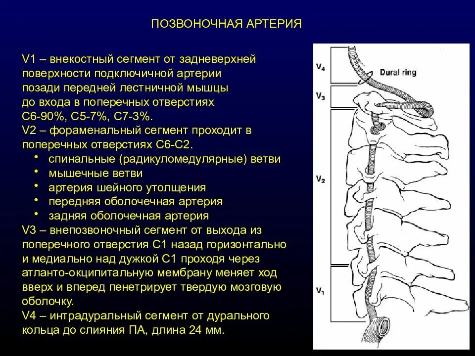 Сегмент v1 позвоночной артерии. V3 сегмент позвоночной артерии. Сегменты v1 v2 позвоночных артерий. V1 сегмент позвоночных артерий.