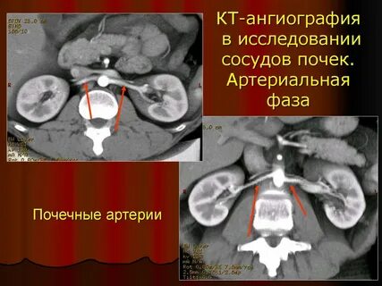 Почечная фаза